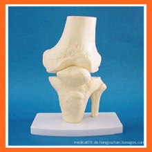 Knie Anatomische Simulation Knie Gelenk Skelett Modell für medizinische Lehre